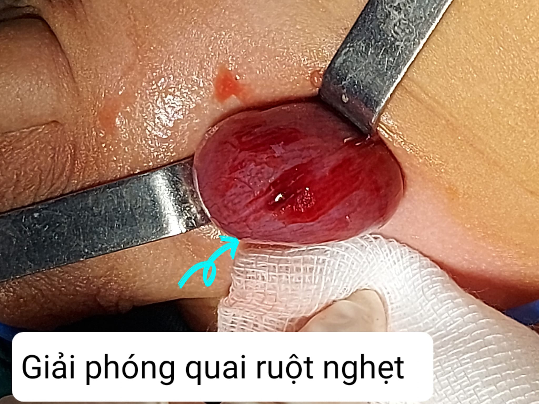 blog-post-image