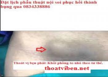 blog-post-image